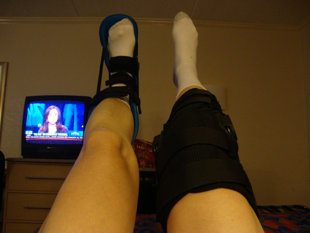 It's Fox News's "The Five" with Achilles and knee braces at the Motel 6! Friday, April 5, 2013.