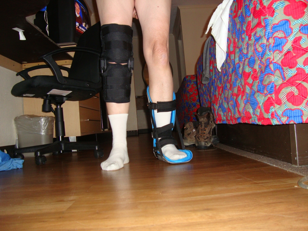 At the Gatlinburg Motel 6... this is actually a trumped-up photo. I wore the knee brace only during the day, and the Achilles splint only at night.